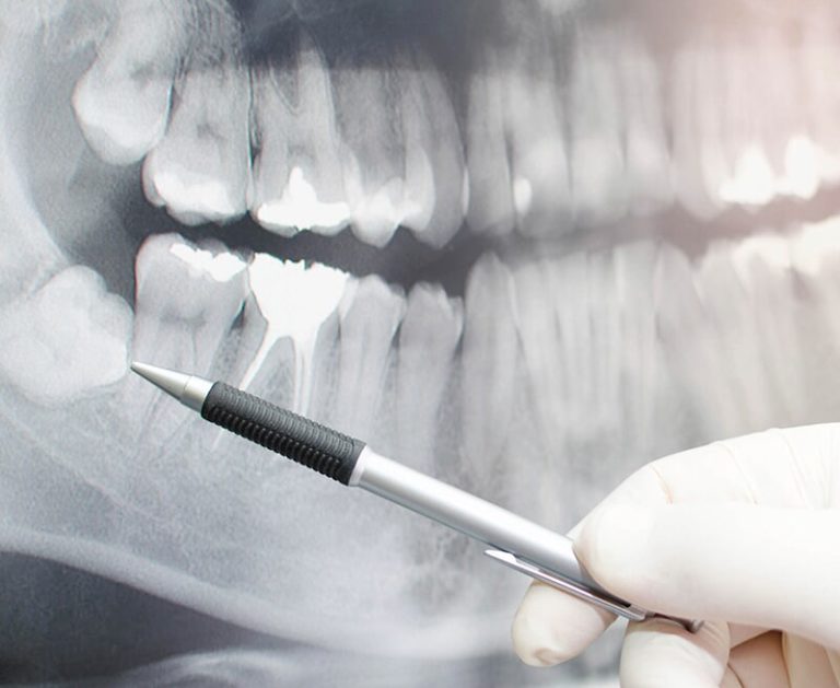 Preventive Dental Services Dental on Martyn